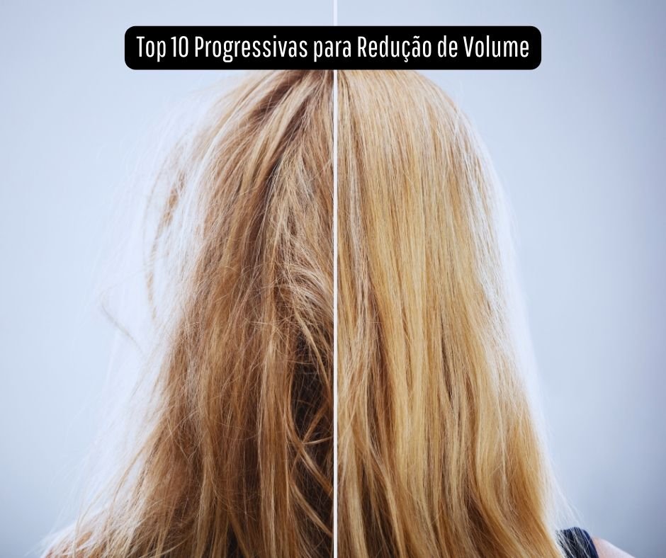 Conheça as Top 10 Progressivas para Redução de Volume